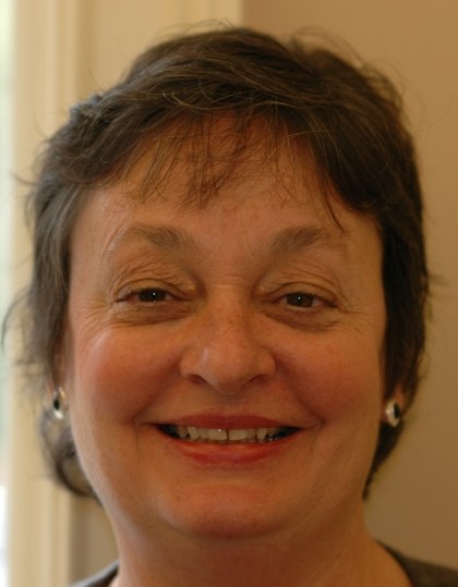 Woman with discolored dental bonding and imperfect smile