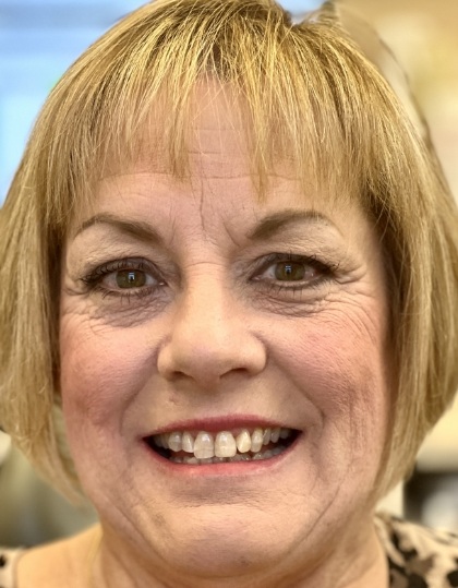 Woman with discolored dental bonding and imperfect smile