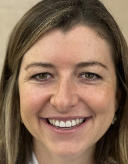 Woman with discolored dental bonding and imperfect smile