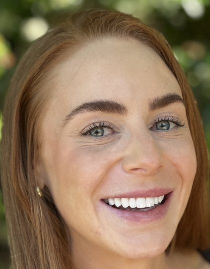 Woman with flawless smile after porecelain veneer treatment